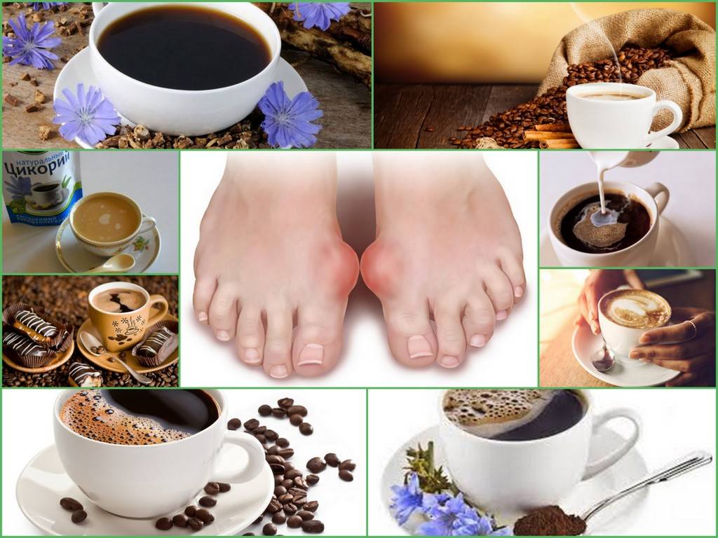 Влияние кофе на суставы и кости: вред, польза