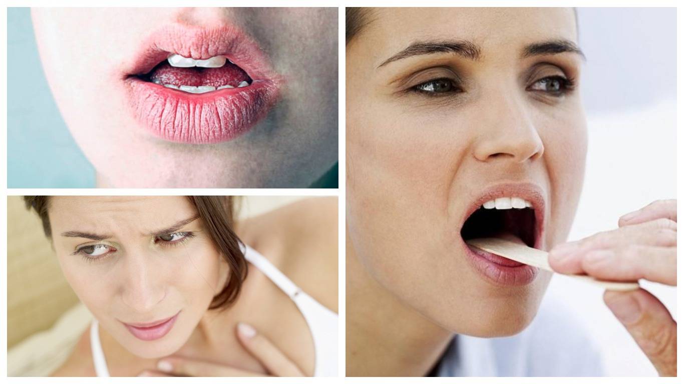 8 причин сухости во рту и 9 способов их устранить