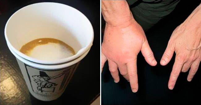 Можно ли умереть от кофе: сколько чашек кофе для этого нужно выпить