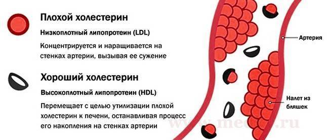 Диета при повышенном холестерине, примерное меню питания при высоком холестерине у женщин - medside.ru
