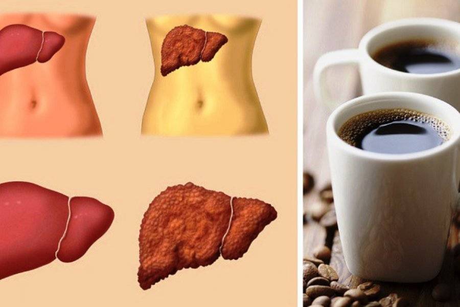 Топ 4 причины, почему от кофе болит желудок
