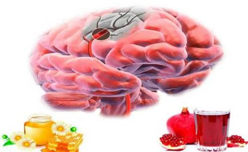 Какой диеты придерживаться при атеросклерозе сосудов головного мозга