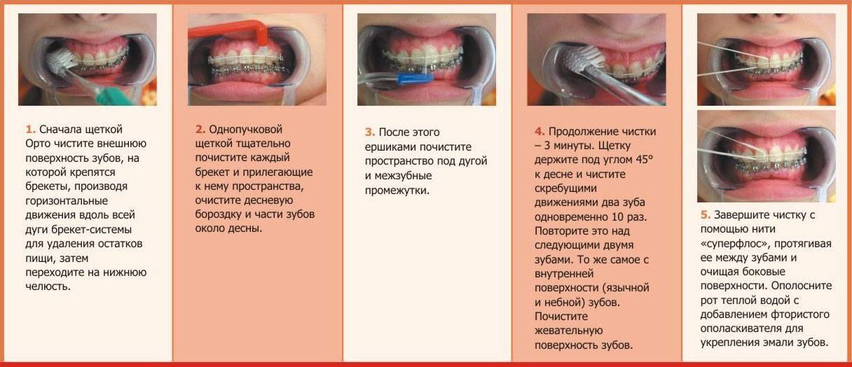 Что делать после удаления зуба