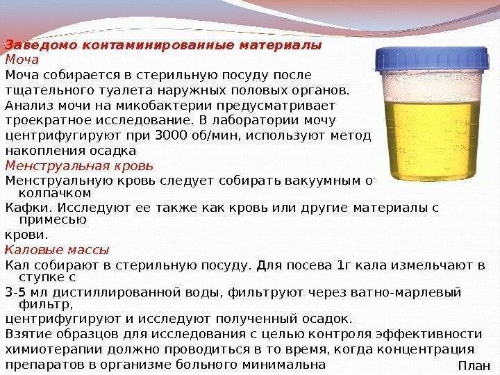 Моча пахнет гречневой кашей