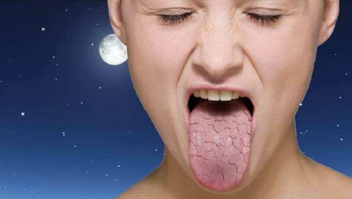 От чего может быть и как лечить сухость во рту? причины и устранение симптома