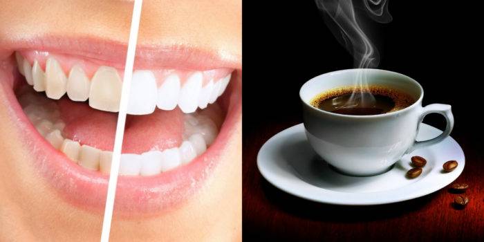 Черный налет на зубах — причины и способы его убрать | dental med