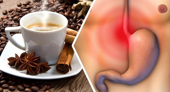 Изжога от кофе – причина или следствие? почему от кофе появляется жжение