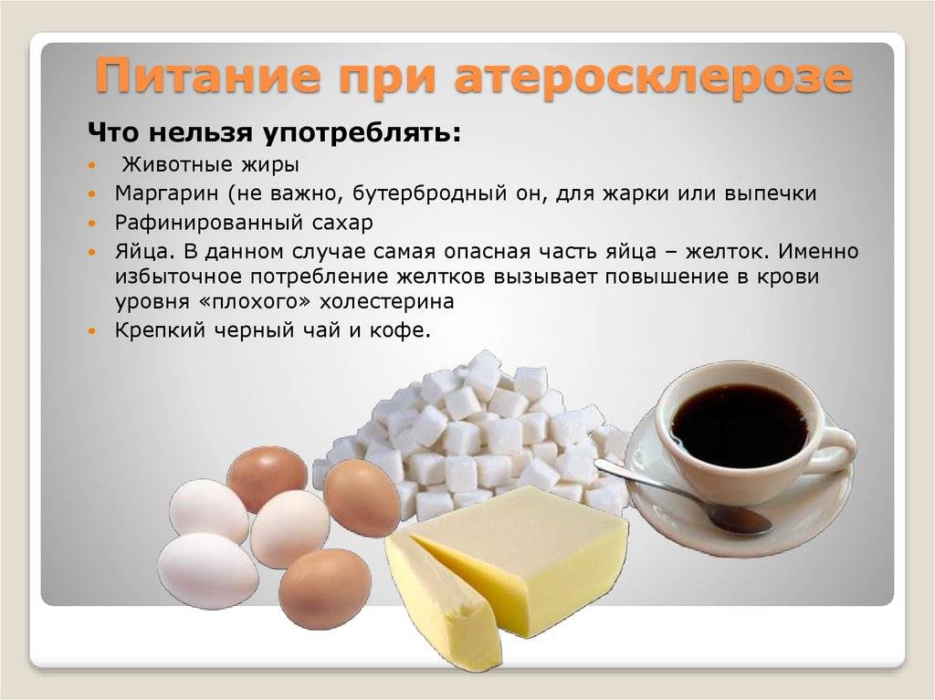Кофе и холестерин, влияние кофе на уровень холестерина, ишемию и ишемическую болезнь сердца